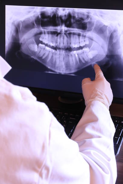 Best Emergency Root Canal Treatment in Franklin, MI