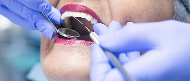 Best Emergency Dentist for Knocked-Out Tooth in Franklin, MI